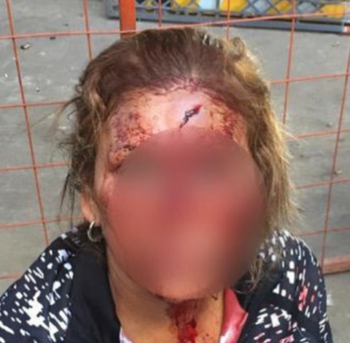 Mujer agredida FOTO: MPFCABA Mujer agredida FOTO: MPFCABA